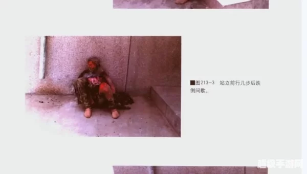 铁道损伤图片